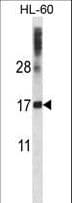 DNAL4 / Dynein Light Chain 4 Antibody (aa1-30)