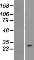 CYB561D1 Protein (Over-Expression Lysate Myc-DDK (Flag))