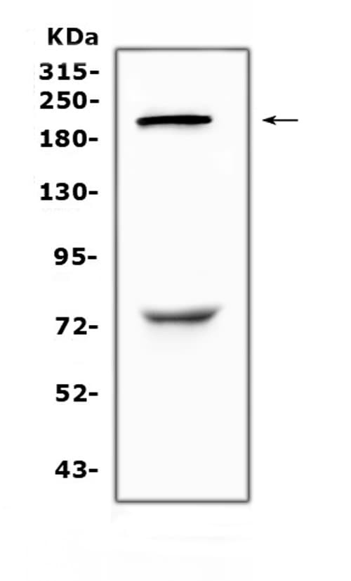 Polyclonal Rabbit anti-Human CHD2 Antibody (IHC, WB)