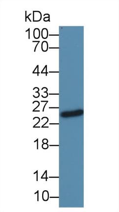 Mouse Anti-Human IgG1 Secondary Antibody (Cy3)