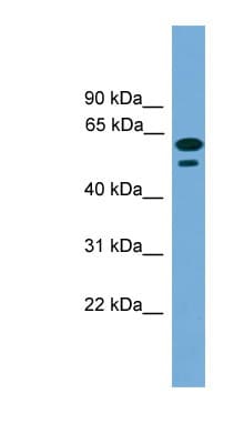 Polyclonal Rabbit anti-Human C19orf45 Antibody (aa215-264, WB)