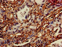 DRAM1 / DRAM Antibody