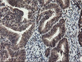 TDO2 Antibody (clone OTI2A4)