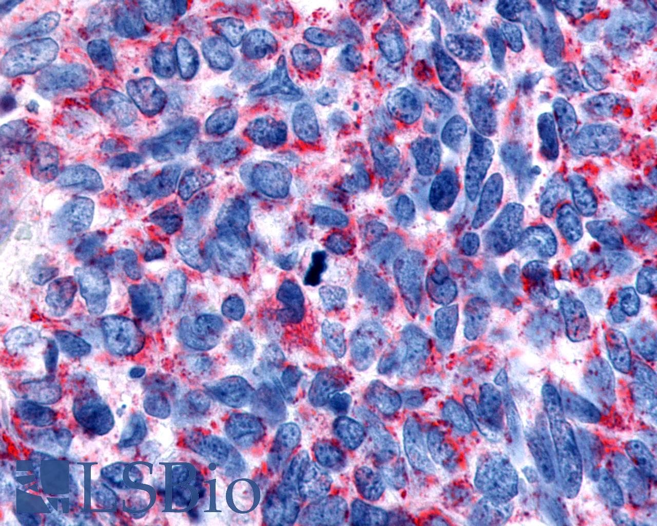 PathPlus™ CHRM2 / M2 Antibody (Cytoplasmic Domain)