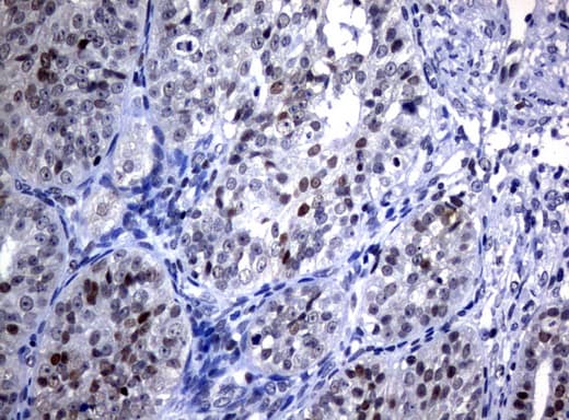 JUN / c-Jun Antibody (clone UMAB67)