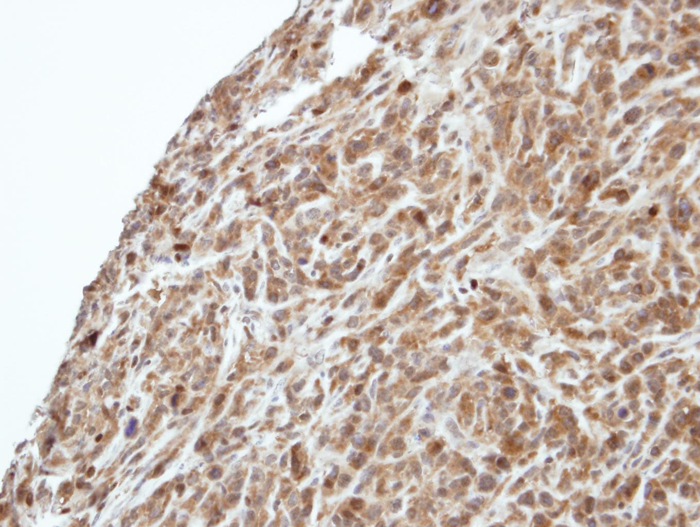 PIK3R3 / p85 Gamma Antibody (aa192-427)