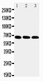 Polyclonal Rabbit anti-Human IRAK3 / IRAKM / IRAK-M Antibody (aa543-562, WB)