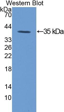 PRKCG / PKC-Gamma Antibody (aa351-614)