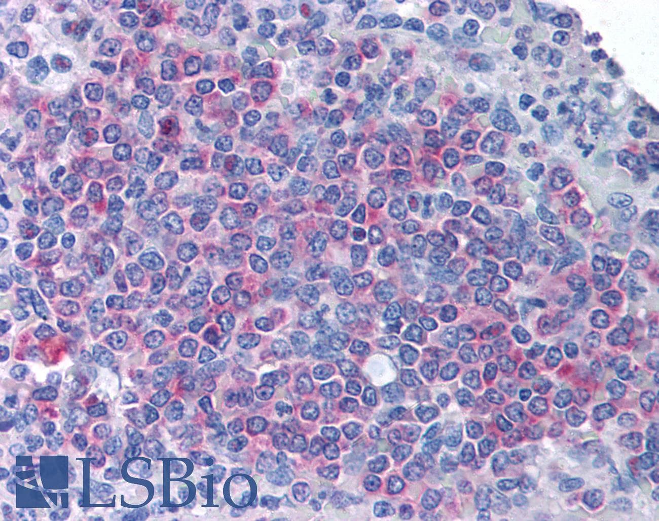 IHC-plus™ MD-1 / LY86 Antibody