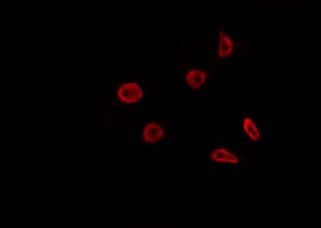Polyclonal Rabbit anti-Human TOP1 / Topoisomerase I Antibody (IF, WB)