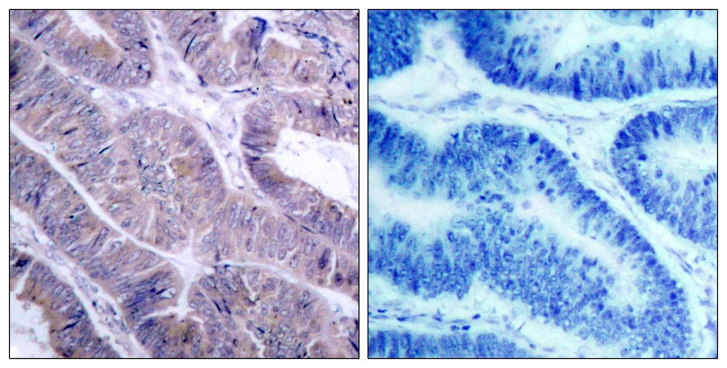 Polyclonal Rabbit anti-Human PRKAA1 + PRKAA2 Antibody (p485/491, IHC, WB)