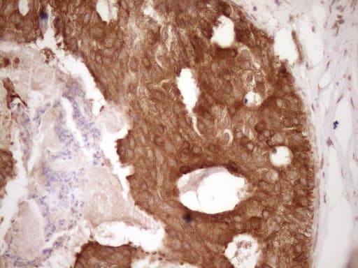 BCL2 / Bcl-2 Antibody (clone OTI9D3)