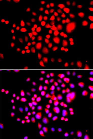 Polyclonal Rabbit anti-Human STK19 Antibody (IF, WB)