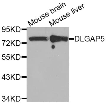 HURP / DLGAP5 Antibody