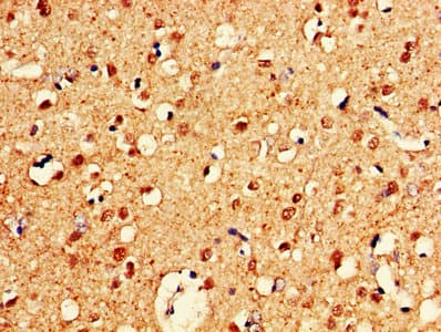 CELF2 / CUGBP2 Antibody