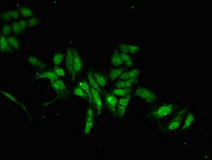 Polyclonal Rabbit anti-Human MAB21L2 Antibody (IF, WB)