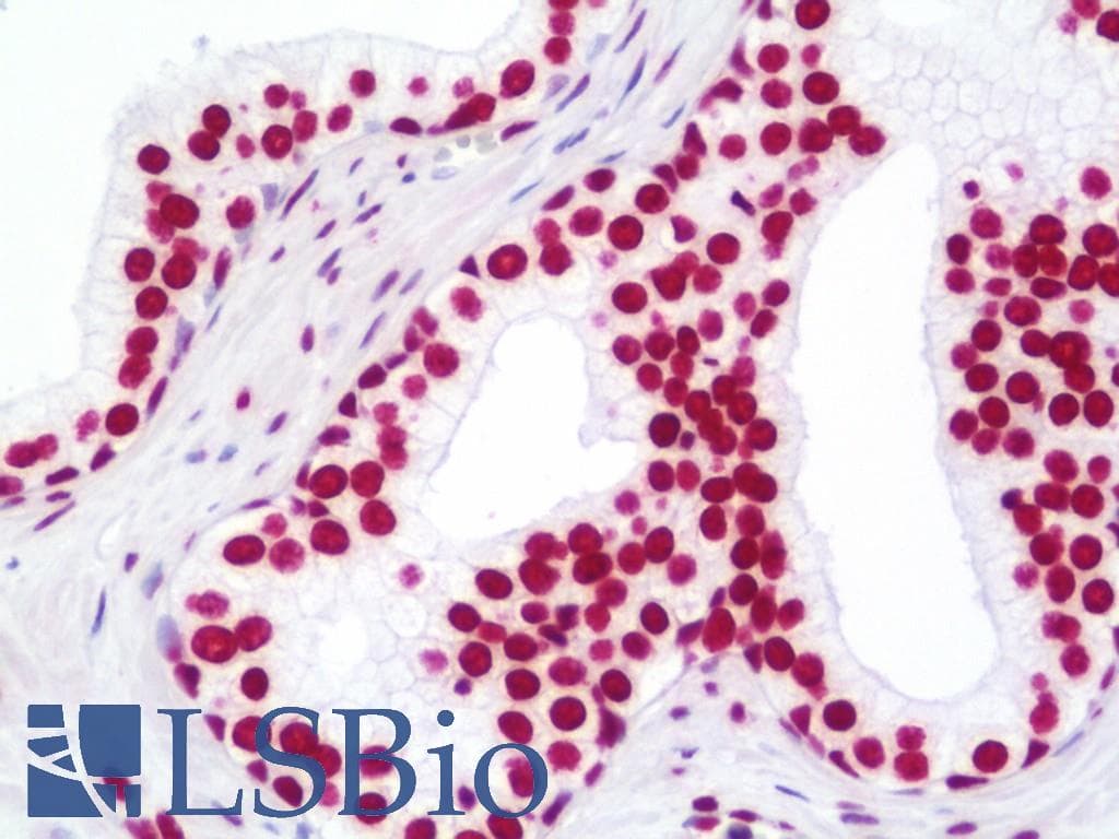 IHC-plus™ Polyclonal Rabbit anti-Human NUMA1 / NUMA Antibody (aa900-950, IHC, IF)