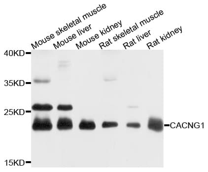 IHC-plus™ Polyclonal Rabbit anti-Human CACNG1 / CACNG Antibody (IHC, WB)