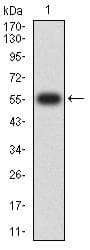 FCGRT / FCRN Antibody (clone 5F3D1)