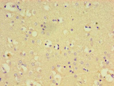 PTPN5 / STEP Antibody (aa300-555)