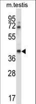 Polyclonal Rabbit anti-Human CSNK1G1 / CKI-Gamma 1 Antibody (aa359-387, IHC, WB)