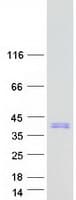 Human SRA1 / SRA Protein (Recombinant Myc-DDK (Flag))