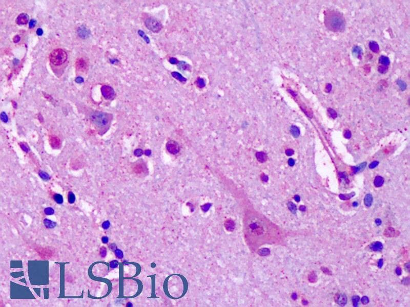 IHC-plus™ GRM7 / MGLUR7 Antibody (Extracellular Domain)