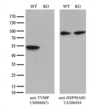 Monoclonal Mouse anti-Human TP / Thymidine Phosphorylase Antibody (clone UMAB90, aa311-482, IHC, WB)