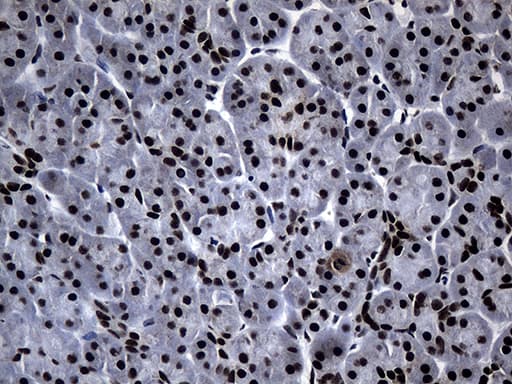 POLR2A / RNA polymerase II Antibody (aa1351-1614, clone OTI2B7)