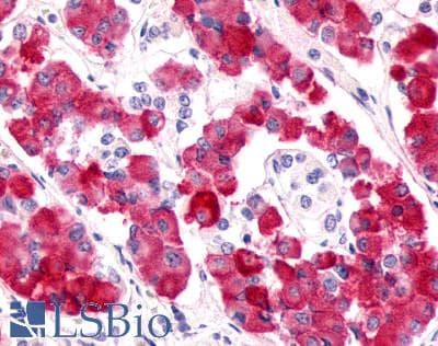 PathPlus™ Polyclonal Rabbit anti-Human GPR17 Antibody (N-Terminus, IHC)