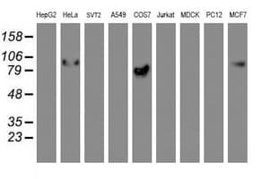 GOLM1 / GP73 / GOLPH2 Antibody (clone OTI4B12)