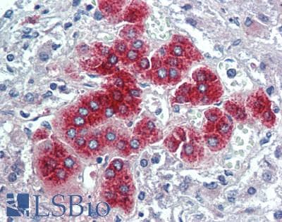 IHC-plus™ SGSH Antibody