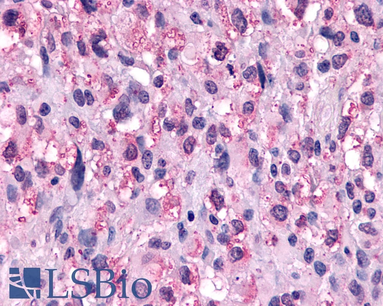 PathPlus™ NPFFR1 / GPR147 Antibody (C-Terminus)