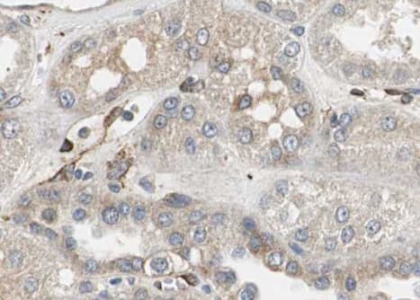 RPL31 / Ribosomal Protein L31 Antibody