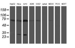 PLDN / Pallidin Antibody (clone OTI1H9)