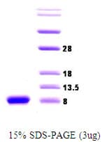 Human SNCA / Alpha-Synuclein Protein (Recombinant)