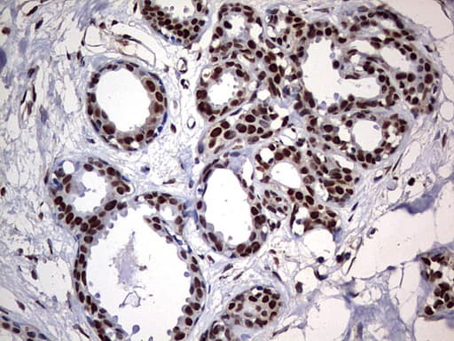HNRPM / HNRNPM Antibody (aa1-261, clone OTI1E12)