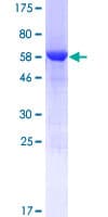 Human STARD7 Protein (Recombinant GST)