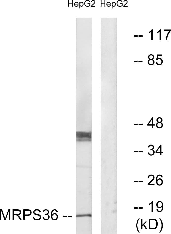 Polyclonal Rabbit anti-Human MRPS36 Antibody (aa4-53, IHC, WB)