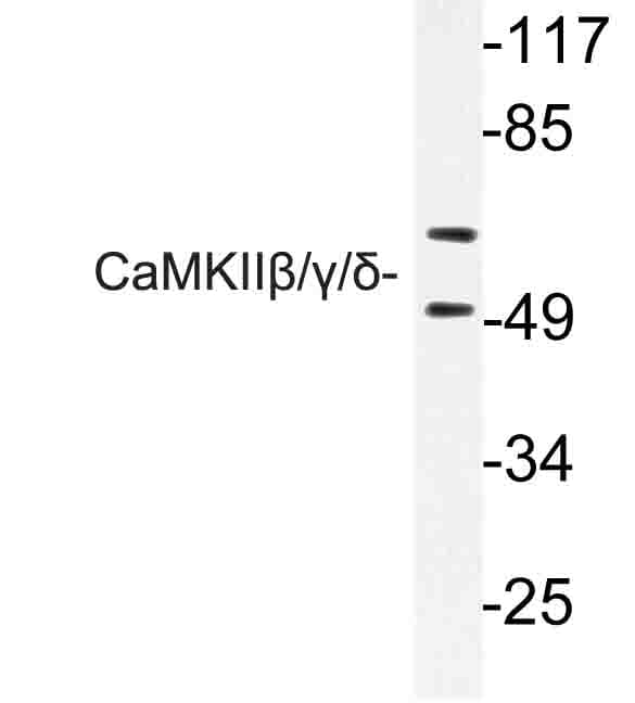 Polyclonal Rabbit anti-Human CaMKII Beta+Gamma+Delta Antibody (Ser280, IHC, WB)