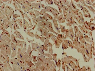ASAH1 / Acid Ceramidase Antibody