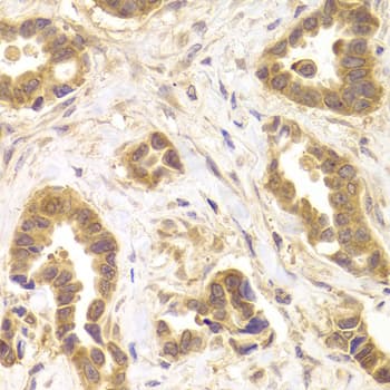 ROCK2 Antibody