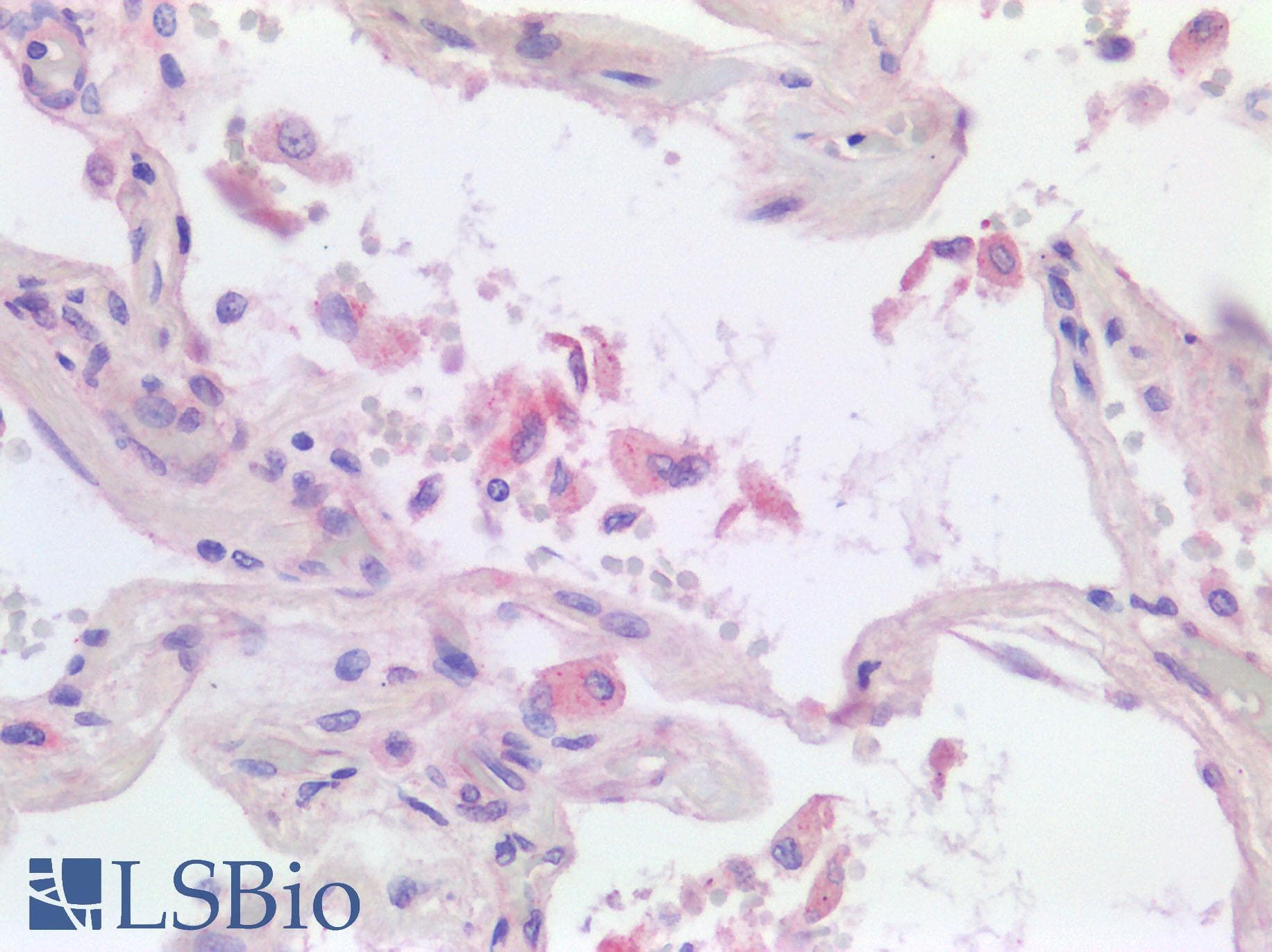 Polyclonal Rabbit anti-Human FCGR3A / CD16A Antibody (IHC, IF)