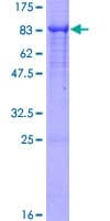 Human PLAP / Alkaline Phosphatase Protein (Recombinant GST)
