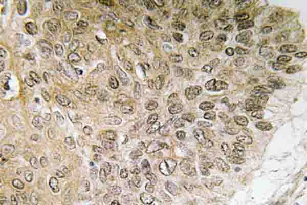 PIK3R1 / p85 Alpha Antibody (Gln498)