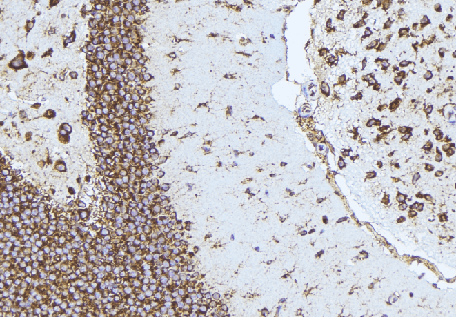 NPPB / BNP Antibody
