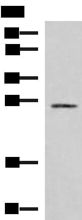 SNRPB2 Antibody