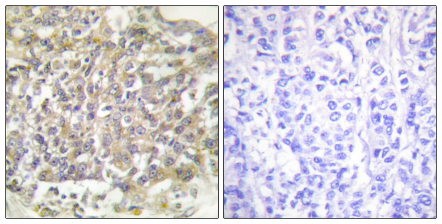 p66 / SHC Antibody (aa315-364)