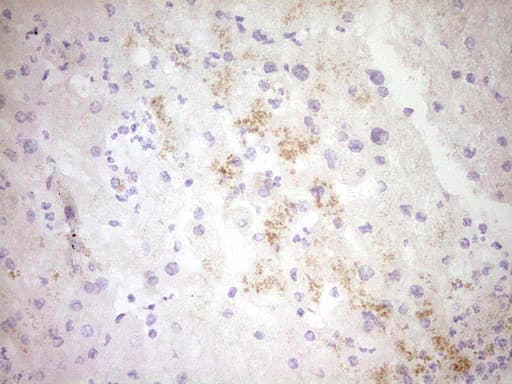 CTGF Antibody (aa27-349, clone OTI6D1)