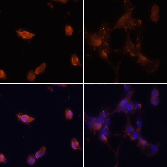 MAP1LC3B / LC3B Antibody